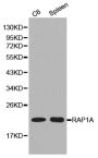 Anti-RAP1A antibody (39-138) (STJ25296)