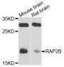 Anti-RAP2B antibody (1-183) (STJ25300)