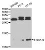Anti-S100A10 antibody (1-97) (STJ25429)