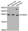 Anti-S100A3 antibody (1-101) (STJ25430)
