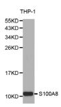 Anti-S100A8 antibody (1-93) (STJ25434)