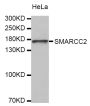Anti-SMARCC2 antibody (150-250) (STJ25617)