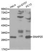 Anti-SNAP25 antibody (1-206) (STJ25637)