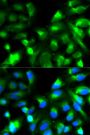 Anti-SNAP25 antibody (1-206) (STJ25637)