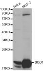 Anti-SOD1 antibody (2-154) (STJ25653)