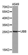 Anti-UBB antibody (1-229) (STJ26010)