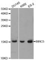 Anti-BIRC5 antibody (1-142) (STJ26172)