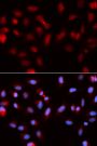 Anti-BIRC5 antibody (1-142) (STJ26172)