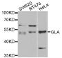 Anti-GLA antibody (150-429) (STJ26175)