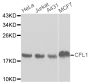 Anti-CFL1 antibody (1-100) (STJ26176)