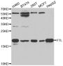 Anti-FTL antibody (1-175) (STJ26177)