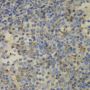 Anti-FTL antibody (1-175) (STJ26177)