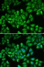 Anti-FTL antibody (1-175) (STJ26177)