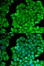 Anti-CCND2 antibody (1-289) (STJ26178)
