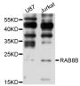 Anti-RAB8B antibody (1-207) (STJ26440)