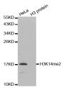 Anti-Di-Methyl-Histone H3-K14 antibody (STJ27231)