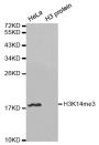 Anti-Tri-Methyl-Histone H3-K14 antibody (10-20) (STJ27232)