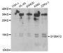 Anti-S100A12 antibody (1-92) (STJ27281)