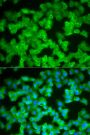 Anti-S100A12 antibody (1-92) (STJ27281)