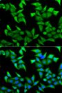 Anti-NECTIN2 antibody (382-479) (STJ27331)