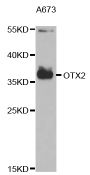 Anti-OTX2 antibody (140-280) (STJ27428)