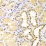Anti-S100A11 antibody (1-105) (STJ27439)