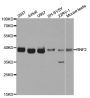 Anti-RNF2 antibody (1-336) (STJ27509)