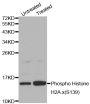 Anti-Phospho-Histone H2A-S139 antibody (STJ27513)
