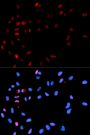 Anti-Phospho-Histone H2A-S139 antibody (STJ27513)