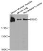 Anti-ERBB3 antibody (1275-1342) (STJ27527)