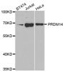 Anti-PRDM14 antibody (1-260) (STJ27532)