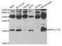 Anti-MAP1LC3A/MAP1LC3B antibody (1-60) (STJ27585)