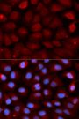 Anti-FMR1 antibody (1-290) (STJ27612)
