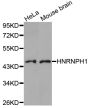 Anti-HNRNPH1 antibody (191-449) (STJ27720)