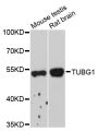 Anti-TUBG1 antibody (382-451) (STJ27971)