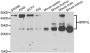 Anti-BNIP3L antibody (95-180) (STJ28205)