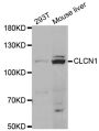 Anti-CLCN1 antibody (779-988) (STJ28306)