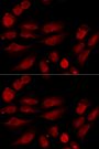 Anti-TP53BP1 antibody (895-1031) (STJ28324)
