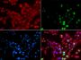 Anti-TP53BP1 antibody (895-1031) (STJ28324)