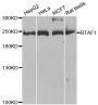 Anti-BTAF1 antibody (1600-1849) (STJ28374)
