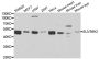 Anti-SUV39H2 antibody (141-350) (STJ28418)