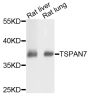Anti-TSPAN7 antibody (140-249) (STJ28500)