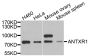 Anti-ANTXR1 antibody (84-333) (STJ28608)