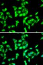 Anti-ANTXR1 antibody (84-333) (STJ28608)