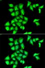Anti-MSRB1 antibody (1-94) (STJ28820)