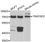 Anti-TRAF3IP2 antibody (1-300) (STJ28859)