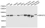Anti-CBFA2T2 antibody (325-604) (STJ29113)
