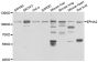 Anti-EPHA2 antibody (280-530) (STJ29263)