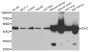 Anti-IDH2 antibody (193-452) (STJ29270)