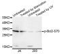 Anti-Phospho-BCL2-S70 antibody (STJ29341)